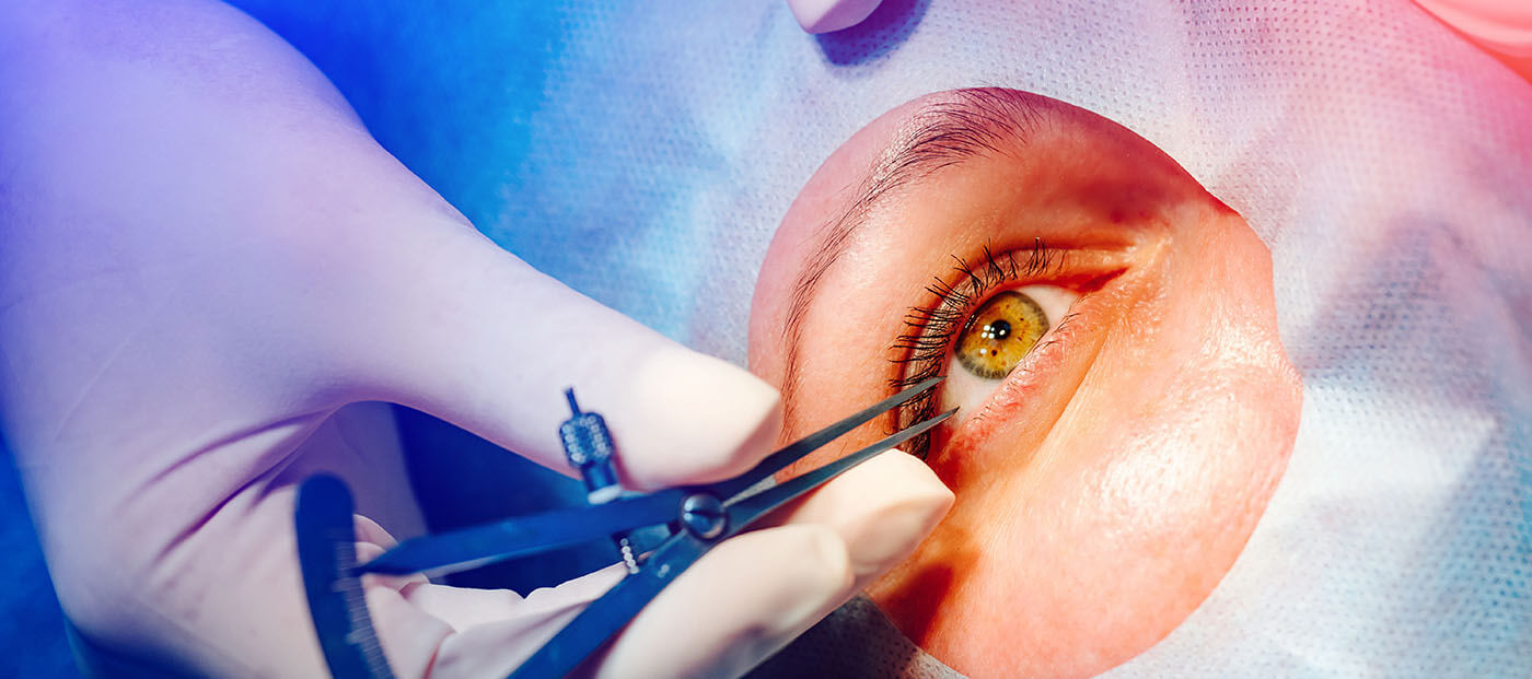 cataract surgery